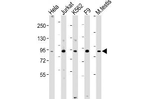 All lanes : Anti-NUP93 Antibody (N-Term) at 1:2000 dilution Lane 1: Hela whole cell lysate Lane 2: Jurkat whole cell lysate Lane 3: K562 whole cell lysate Lane 4: F9 whole cell lysate Lane 5: Mouse testis lysate Lysates/proteins at 20 μg per lane. (NUP93 antibody  (AA 20-54))