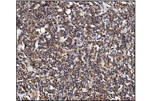 IHC analysis of POGLUT1 using anti-POGLUT1 antibody (ABIN7602910).