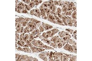 Immunohistochemical staining (Formalin-fixed paraffin-embedded sections) of human heart muscle shows strong granular positivity in myocytes.