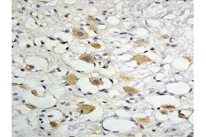 Immunohistochemistry (IHC) image for anti-Tight Junction Protein 1 (TJP1) (AA 1551-1702) antibody (ABIN675024)