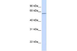 Carboxylesterase 7 antibody used at 1 ug/ml to detect target protein. (CES5A antibody  (N-Term))