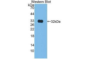 Western blot analysis of the recombinant protein. (Kallikrein 9 antibody  (AA 1-250))