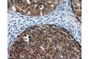 Immunohistochemical staining of paraffin-embedded Kidney tissue using anti-LIPG mouse monoclonal antibody. (LIPG antibody)