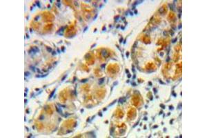 Used in DAB staining on fromalin fixed paraffin-embedded Stomach tissue (Frataxin antibody  (AA 57-198))