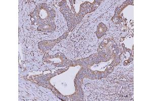 IHC analysis of CLASP1 using anti-CLASP1 antibody (ABIN7599144). (CLASP1 antibody  (AA 1-243))