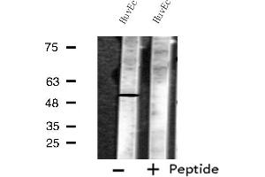 Western blot analysis of extracts from HuvEc cells, using MKNK1 antibody. (MKNK1 antibody  (Internal Region))