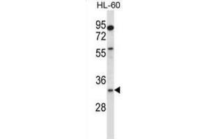 Western Blotting (WB) image for anti-Egl-9 Family Hypoxia Inducible Factor 3 (EGLN3) antibody (ABIN2997822) (EGLN3 antibody)