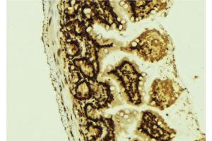 ABIN6267159 at 1/100 staining Mouse colon tissue by IHC-P.