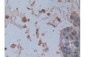 Immunohistochemistry (IHC) image for anti-Alkaline Phosphatase, Liver/bone/kidney (ALPL) (AA 18-335) antibody (ABIN7433150)