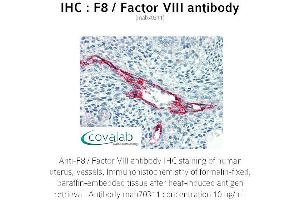 Image no. 1 for anti-Coagulation Factor VIII (F8) antibody (ABIN1723234) (Factor VIII antibody)