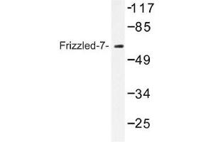 Image no. 1 for anti-Frizzled Family Receptor 7 (FZD7) antibody (ABIN317734) (FZD7 antibody)
