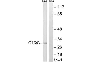 Western blot analysis of extracts from rat lung cells, using C1QC antibody. (C1QC antibody  (Internal Region))