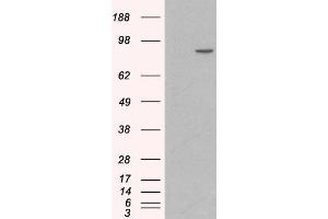 HEK293 overexpressing Human CTNNA1 (RC201766) and probed with ABIN185626 (mock transfection in first lane), tested by Origene. (CTNNA1 antibody  (Internal Region))