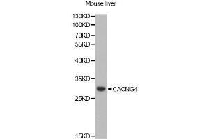Western blot analysis of extracts of mouse liver, using CACNG4 antibody (ABIN2561527) at 1:1000 dilution. (CACNG4 antibody)