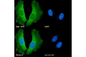 (ABIN5539467) Immunofluorescence analysis of paraformaldehyde fixed HeLa cells, permeabilized with 0. (Aryl Hydrocarbon Receptor antibody  (Internal Region))