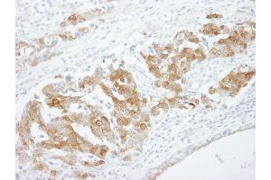 Immunohistochemistry (IHC) image for anti-Cellular Retinoic Acid Binding Protein 2 (CRABP2) (C-Term) antibody (ABIN7448487) (CRABP2 antibody  (C-Term))