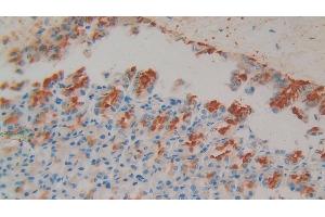 Detection of GP1BB in Rat Stomach Tissue using Polyclonal Antibody to Platelet Glycoprotein Ib Beta Chain (GP1BB) (GP1BB antibody  (AA 52-164))