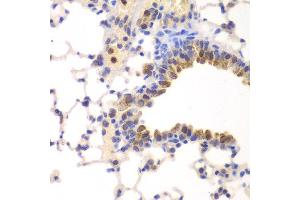 Immunohistochemistry of paraffin-embedded mouse lung using NFKB1 antibody at dilution of 1:200 (400x lens). (NFKB1 antibody)