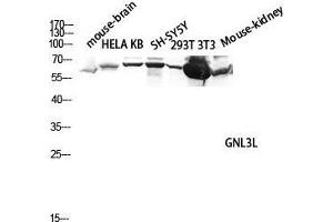 Western Blotting (WB) image for anti-Guanine Nucleotide Binding Protein-Like 3 (Nucleolar)-Like (GNL3L) (Internal Region) antibody (ABIN6283782)