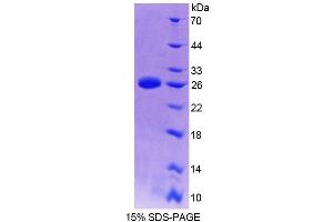 SDS-PAGE analysis of Mouse TMEM1 Protein. (TRAPPC10 Protein)