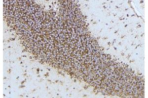 Immunohistochemistry (IHC) image for anti-ADAM Metallopeptidase with Thrombospondin Type 1 Motif, 4 (ADAMTS4) (Internal Region) antibody (ABIN6259788)