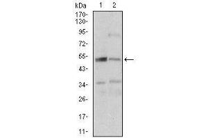 Western blot analysis using DAPK3 mouse mAb against A431 (1), K562 (2) cell lysate.