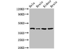 Western Blot Positive WB detected in: Hela whole cell lysate, Rat brain tissue, Mouse kidney tissue, Mouse brain tissue All lanes: ATAD1 antibody at 4 μg/mL Secondary Goat polyclonal to rabbit IgG at 1/50000 dilution Predicted band size: 41, 33 kDa Observed band size: 41 kDa (ATAD1 antibody  (AA 289-350))