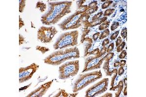 IHC analysis of EpCAM using anti-EpCAM antibody (ABIN7600081).