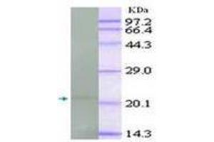 Image no. 1 for anti-Tumor Necrosis Factor alpha (TNF alpha) antibody (ABIN791557) (TNF alpha antibody)