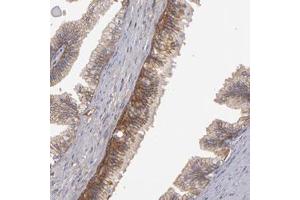 Immunohistochemical staining of human prostate with ABCC4 polyclonal antibody  shows cytoplasmic and membranous positivity in glandular cells at 1:200-1:500 dilution. (ABCC4 antibody)