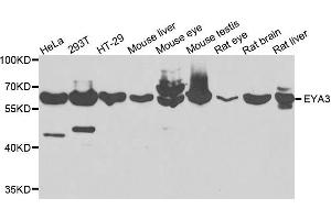 Western blot analysis of extracts of various cells, using EYA3 antibody. (EYA3 antibody)
