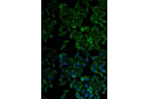 Immunofluorescence analysis of HeLa cell using TNFRSF1A antibody. (TNFRSF1A antibody)