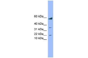 WB Suggested Anti-LYRM1 Antibody Titration: 0. (LYRM1 antibody  (Middle Region))