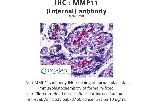 Image no. 1 for anti-Matrix Metallopeptidase 11 (Stromelysin 3) (MMP11) (Internal Region) antibody (ABIN1737007) (MMP11 antibody  (Internal Region))
