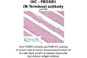 Image no. 1 for anti-Prokineticin Receptor 1 (PROKR1) (Extracellular Domain), (N-Term) antibody (ABIN1738398)