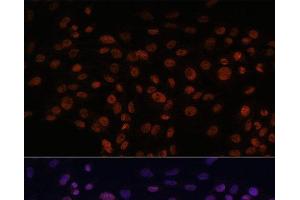 Immunofluorescence analysis of C6 cells using CHD4 Polyclonal Antibody at dilution of 1:100.