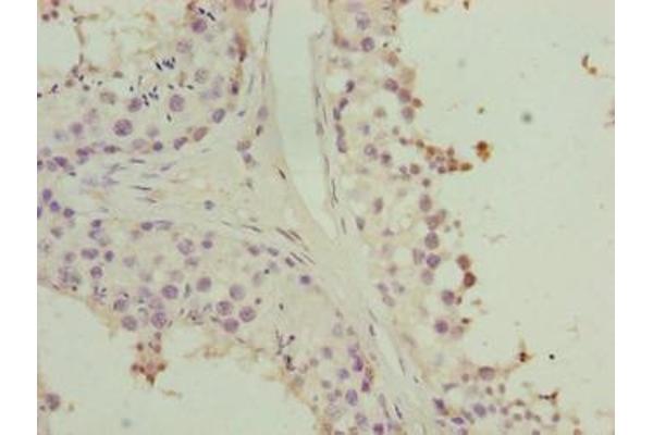 HORMAD2 antibody  (AA 14-307)
