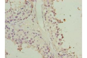 Immunohistochemistry of paraffin-embedded human testis tissue using ABIN7155901 at dilution of 1:100 (HORMAD2 antibody  (AA 14-307))