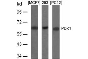 Image no. 4 for anti-3-phosphoinositide Dependent Protein Kinase-1 (PDPK1) (Ser241) antibody (ABIN197100) (PDPK1 antibody  (Ser241))