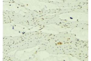 ABIN6277663 at 1/100 staining Mouse muscle tissue by IHC-P.