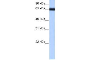 WB Suggested Anti-ZNF14 Antibody Titration:  0. (ZFP14 antibody  (N-Term))
