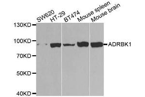 Western blot analysis of extracts of various cell lines, using ADRBK1 antibody. (GRK2 antibody  (AA 440-689))