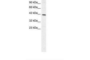 Image no. 2 for anti-Forkhead Box F2 (FOXF2) (AA 52-101) antibody (ABIN202540) (FOXF2 antibody  (AA 52-101))
