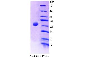 SDS-PAGE (SDS) image for Megakaryocyte-Associated tyrosine Kinase (MATK) (AA 1-173) protein (His tag) (ABIN6239117)