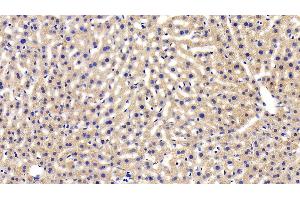 Detection of LEPR in Mouse Liver Tissue using Polyclonal Antibody to Leptin Receptor (LEPR) (Leptin Receptor antibody  (AA 22-203))