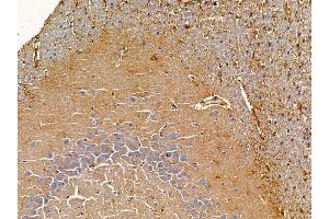 ABIN6265684 and ABIN6278747 at 1/100 staining rat brain tissue by IHC-P. (TPD52L1 antibody  (N-Term))