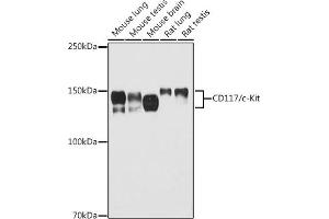 Western blot analysis of extracts of various cell lines, using CD117/c-Kit antibody (ABIN6133454, ABIN6142896, ABIN6142898 and ABIN6213818) at 1:500 dilution.