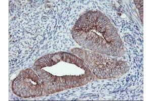 Image no. 1 for anti-Carboxypeptidase A2 (Pancreatic) (CPA2) antibody (ABIN1497596) (Carboxypeptidase A2 antibody)