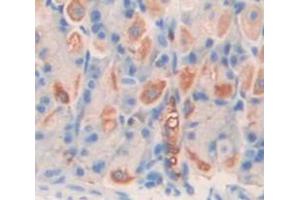 IHC-P analysis of Mouse Tissue, with DAB staining. (Chitotriosidase 1 antibody  (AA 210-464))