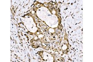 IHC analysis of KLF15 using anti-KLF15 antibody (ABIN7599269). (KLF15 antibody  (AA 1-323))